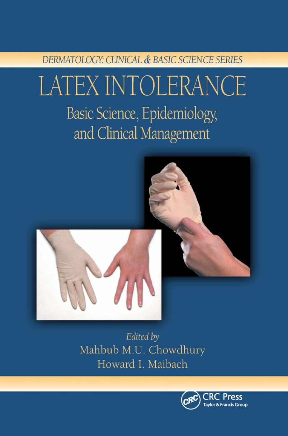 LaTeX Intolerance: Basic Science, Epidemiology, and Clinical Management