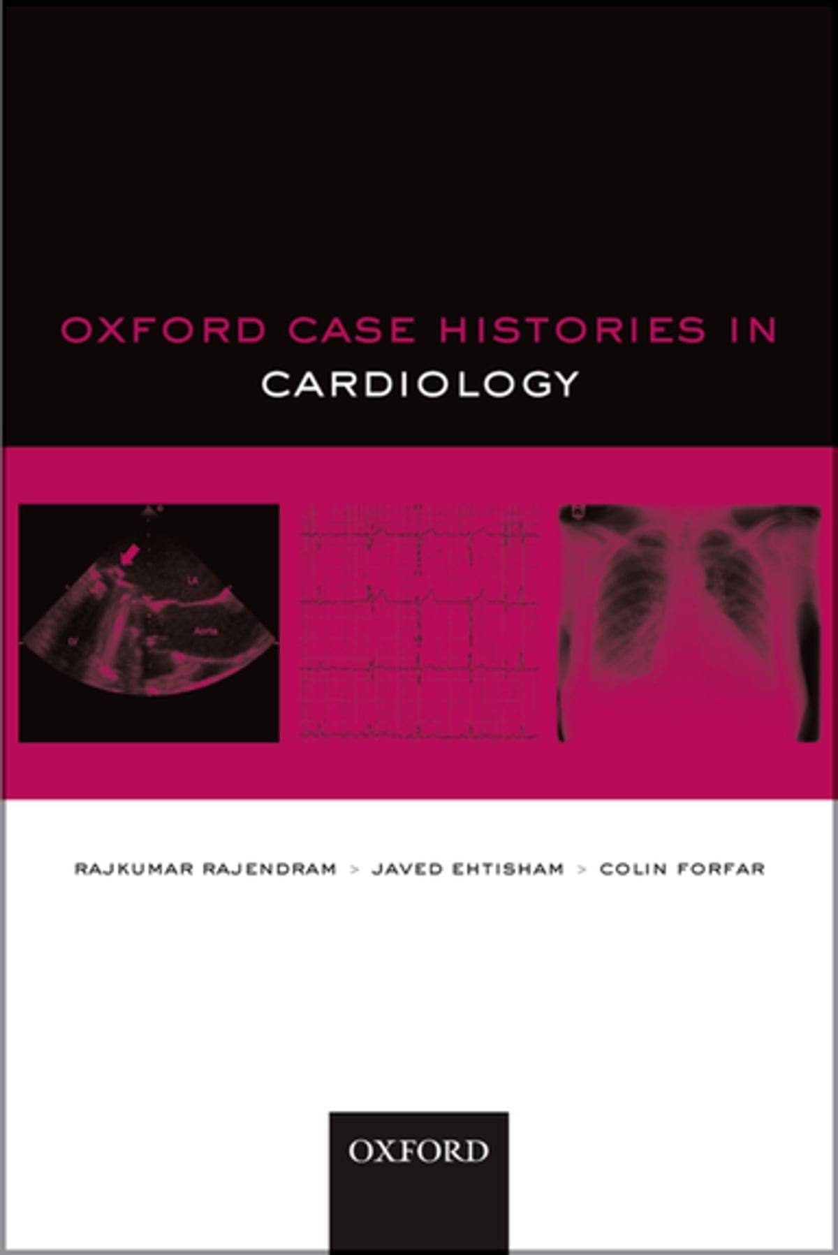 Oxford Case Histories in Cardiology